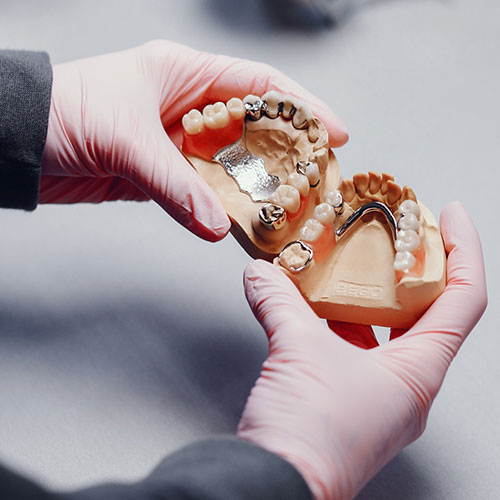 Prótesis Removibles